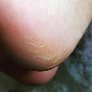 Ольга , Рівне Фото - 10