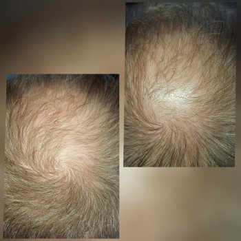 Татьяна Лукашенко, Бровары Фото - 11