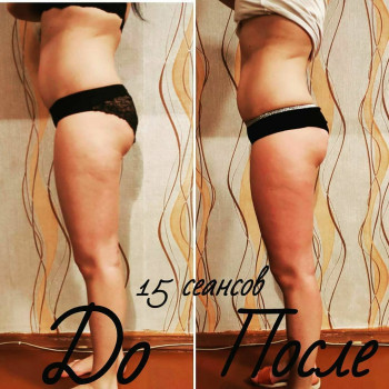 Дмитрий Заржицкий, Черкассы Фото - 10