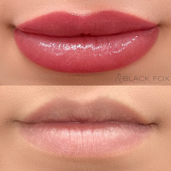 Диана Юркова, Маріуполь Фото - 27