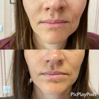 Антонина Бузулан, Николаев Фото - 5