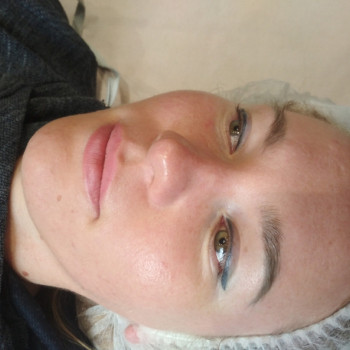 Как результат- свечение кожи сразу после процедуры