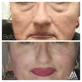 Векторное моделирование лица. Заполнение носогубной и губопо