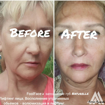 Векторное моделирование лица. Заполнение носогубной и губопо