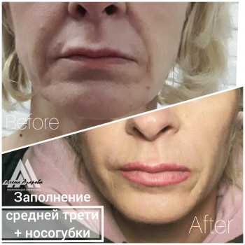 Векторное моделирование лица. Заполнение носогубной и губопо