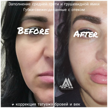 Векторное моделирование лица. Заполнение носогубной и губопо