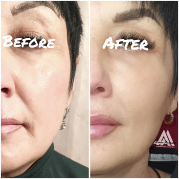 Векторное моделирование лица. Заполнение носогубной и губопо