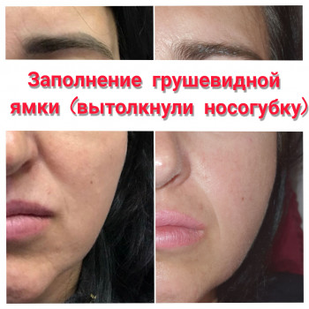 Векторное моделирование лица. Заполнение носогубной и губопо