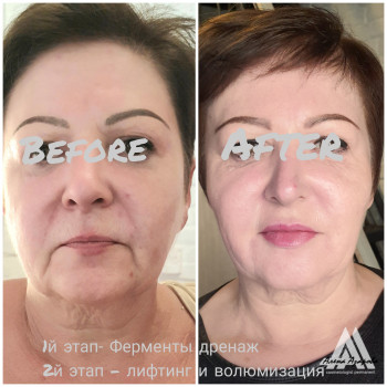 Векторное моделирование лица. Заполнение носогубной и губопо