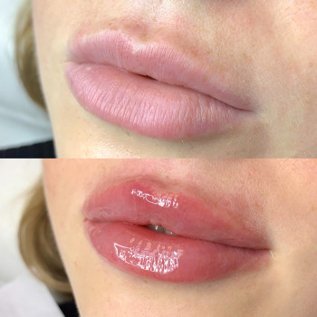 Анна Мунька, Черкассы Фото - 31