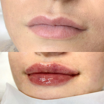 Анна Мунька, Черкассы Фото - 33