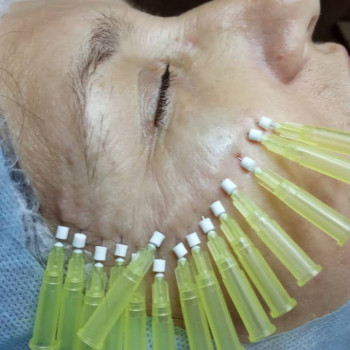 Вікторія Ігнатенко, Київ Фото - 48