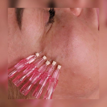 Вікторія Ігнатенко, Київ Фото - 51