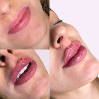 Вікторія Ігнатенко, Київ Фото - 58