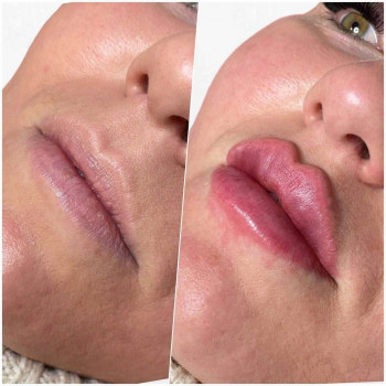 Вікторія Ігнатенко, Київ Фото - 60