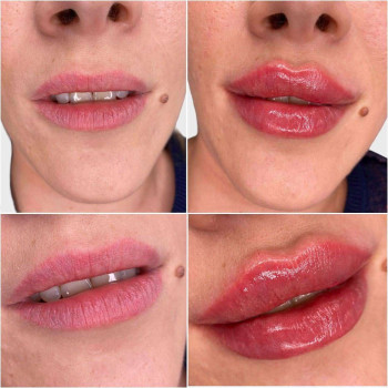 Вікторія Ігнатенко, Київ Фото - 64