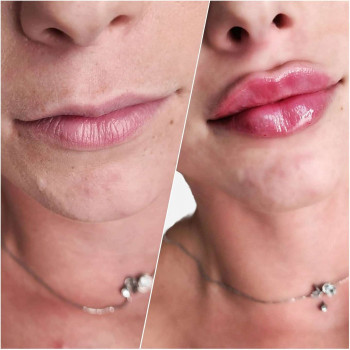 Вікторія Ігнатенко, Київ Фото - 65