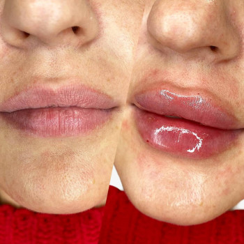 Вікторія Ігнатенко, Київ Фото - 66