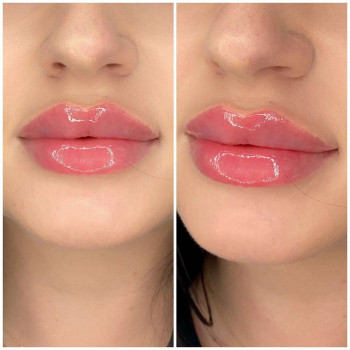 Вікторія Ігнатенко, Київ Фото - 67