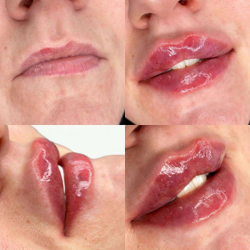 Вікторія Ігнатенко, Київ Фото - 68