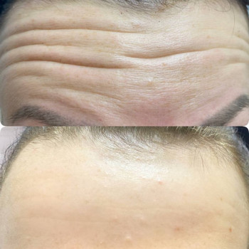 Вікторія Ігнатенко, Київ Фото - 69