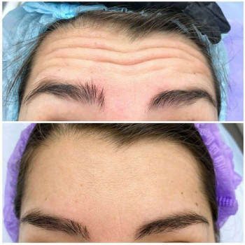 Вікторія Ігнатенко, Київ Фото - 71