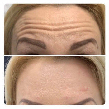 Вікторія Ігнатенко, Київ Фото - 72