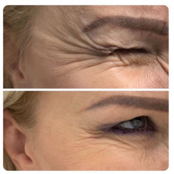 Вікторія Ігнатенко, Київ Фото - 73