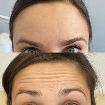 Вікторія Ігнатенко, Київ Фото - 74