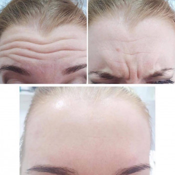 Вікторія Ігнатенко, Київ Фото - 76