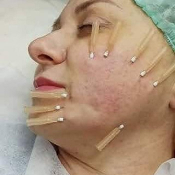 Вікторія Ігнатенко, Київ Фото - 16