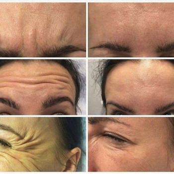 Вікторія Ігнатенко, Київ Фото - 5