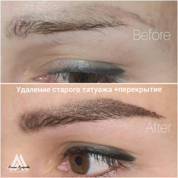 Сочетанная техника