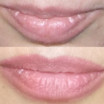 Исправление асимметрии.Техника сочетанная.