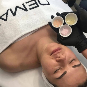 Карбоксітерапія
                    Косметолог Ірина Луцьк