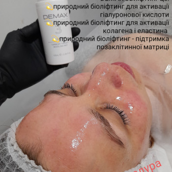 Карбоксітерапія
                    Косметолог Ірина Луцьк