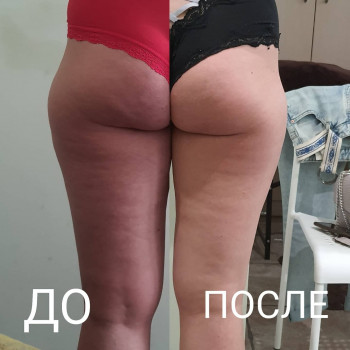 Татьяна , Одесса Фото - 7