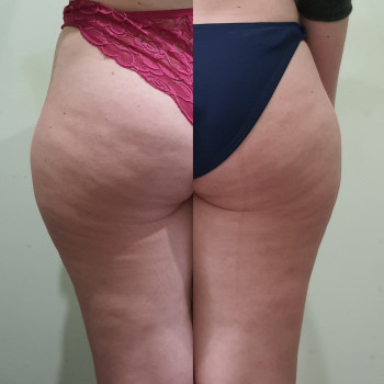 Татьяна , Одесса Фото - 9