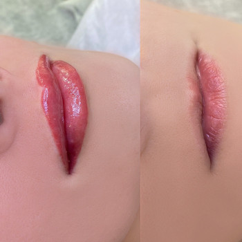 Ольга Малинина, Рівне Фото - 19