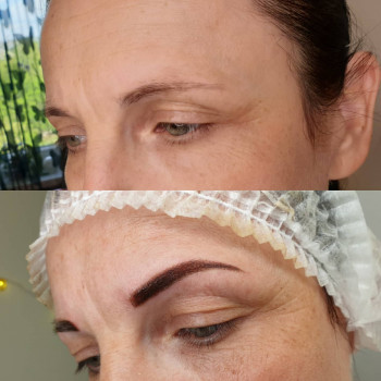 Пудрове напилення
                    Бровіст Христина Чернівці