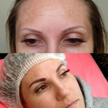 Пудрове напилення
                    Бровіст Христина Чернівці