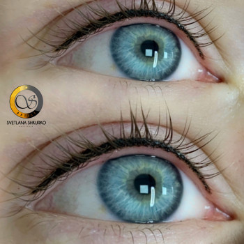 Межресничка