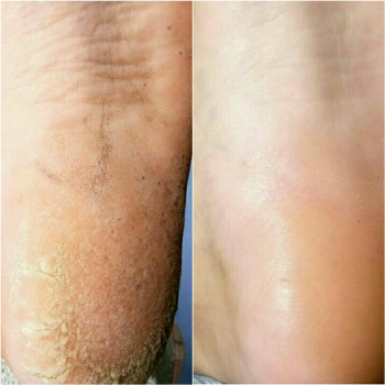 Екатерина , Бердянск Фото - 5