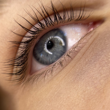 Анастасія Репей, Вінниця Фото - 6