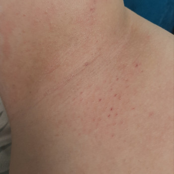 Мирослава Бортник, Киев Фото - 5