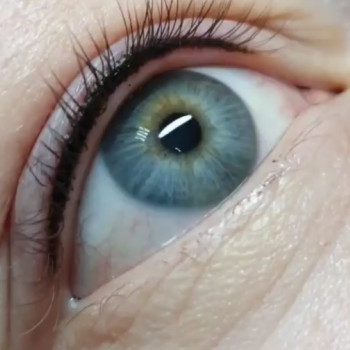 Межресничка.