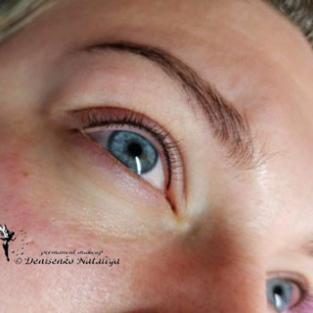 Межресничка.