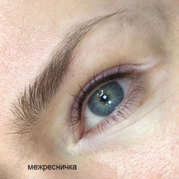 Межресничка.
