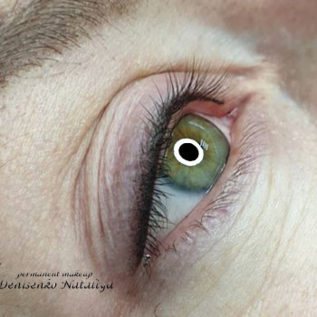 Межресничка.