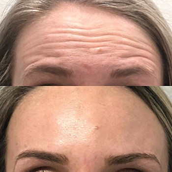 Юлія Чепурна, Полтава Фото - 5